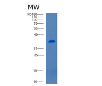 小鼠CD5抗原样重组蛋白