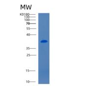 小鼠CD5抗原样重组蛋白