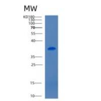 小鼠CD5抗原样重组蛋白
