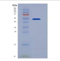 人CD58分子(CD58)重组蛋白