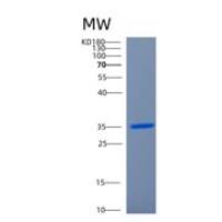 人细胞周期素D2(CCND2)重组蛋白