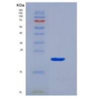 人T-细胞表面糖蛋白CD3γ(CD3g)重组蛋白