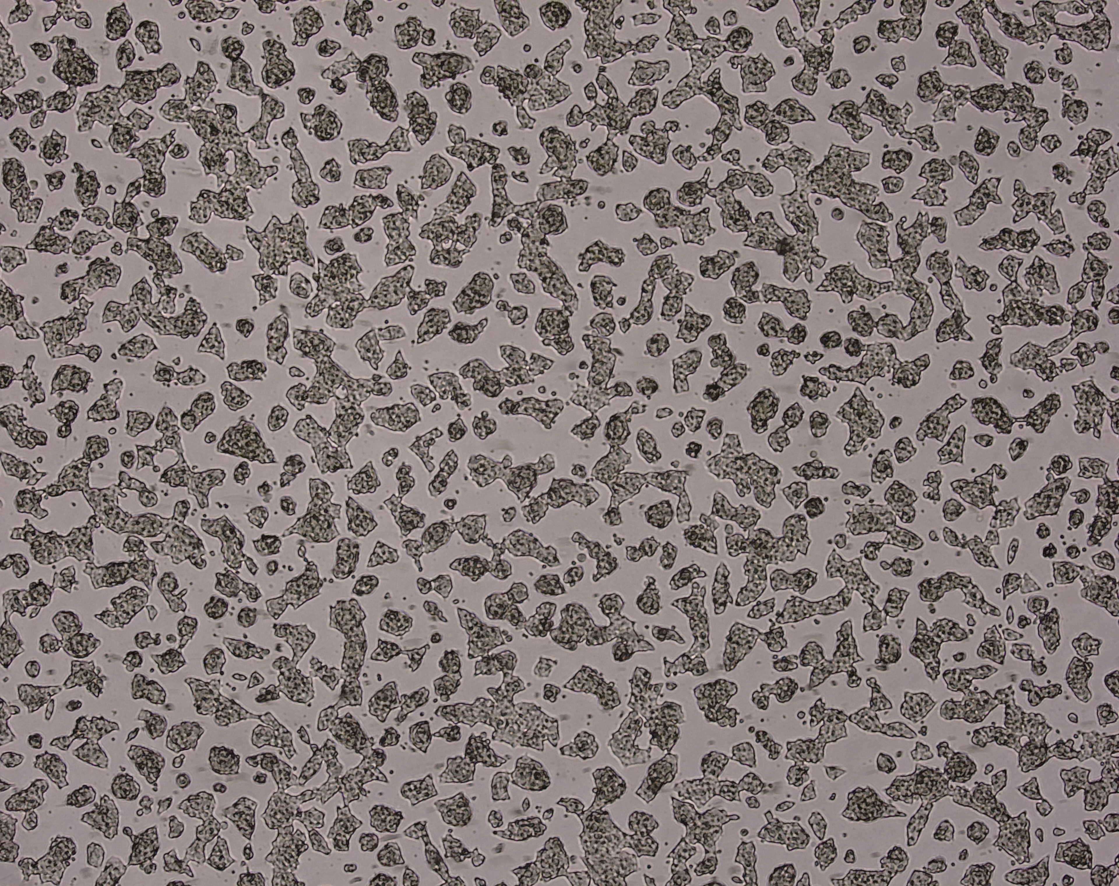 细胞攻略 | AR42J(大鼠胰腺外分泌细胞)培养教程