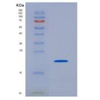 人Ⅱ类主要组织相容性复合体不变链(CD74)重组蛋白