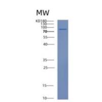 人血管内皮钙黏蛋白(CDH5)重组蛋白