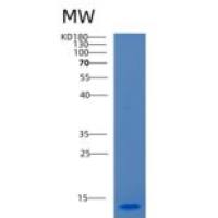 人CCL28重组蛋白