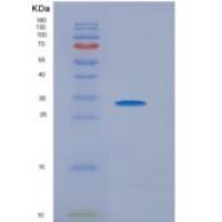 小鼠CD200受体1(CD200R1)重组蛋白