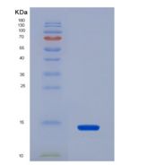 人巨噬细胞炎性蛋白3β(MIP3b)重组蛋白
