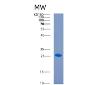 人CD244分子(CD244)重组蛋白