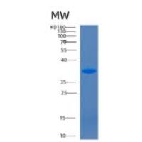 小鼠CD14分子(CD14)重组蛋白