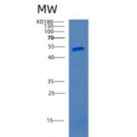 人癌胚抗原相关细胞粘附分子1(CEACAM1)重组蛋白