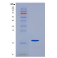 人二级淋巴组织趋化因子(SLC)重组蛋白