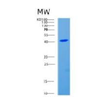 人细胞分裂周期因子123(CDC123)重组蛋白