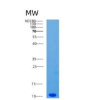 人趋化因子C-C-基元配体1(CCL1)重组蛋白