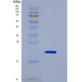 人保护素(CD59)重组蛋白