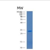 人CD1a分子(CD1a)重组蛋白