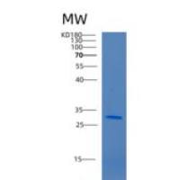 人唾液酸结合Ig样凝集素3(CD33)重组蛋白
