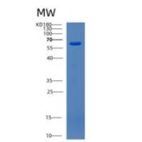 人CDK5RAP3重组蛋白