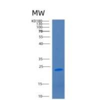 人CD2分子(CD2)重组蛋白