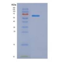 人CD40配体(CD40L)重组蛋白