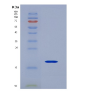 人CD247分子(CD247)重组蛋白
