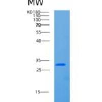 人CCDC43重组蛋白