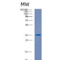 人周期素依赖性激酶2(CDK2)重组蛋白