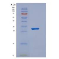 人CD1e分子(CD1e)重组蛋白