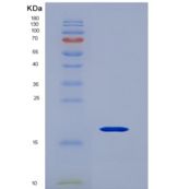 人CD247分子(CD247)重组蛋白