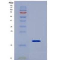 人CD247分子(CD247)重组蛋白
