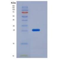 人免疫球蛋白关联β(CD79B)重组蛋白