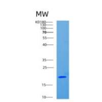 人CD8b分子(CD8b)重组蛋白