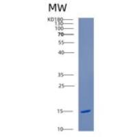 人着丝粒蛋白H(CENPH)重组蛋白