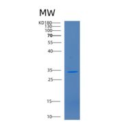 人CD1b分子(CD1b)重组蛋白