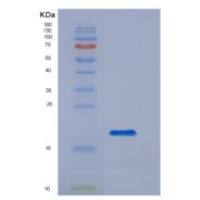 人CD14分子(CD14)重组蛋白