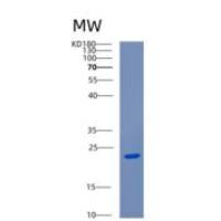 人CENPM重组蛋白