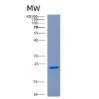 人CHAC2重组蛋白
