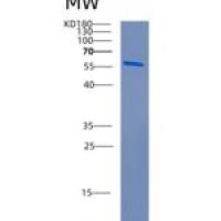 人Cornulin蛋白(CRNN)重组蛋白