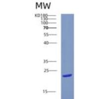 人CRYGN重组蛋白