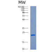 人C反应蛋白(CRP)重组蛋白