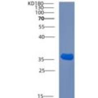 人促肾上腺皮质素释放激素结合蛋白(CRHBP)重组蛋白