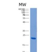 人CLEC4E重组蛋白
