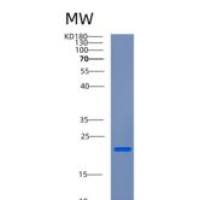 人中心体蛋白2(CETN2)重组蛋白