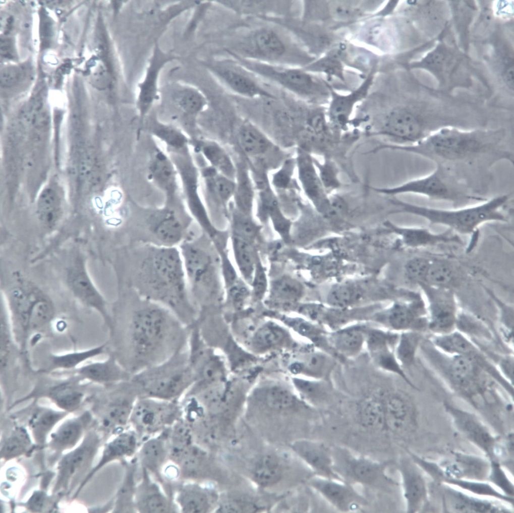 HSF、HSF细胞、HSF人皮肤成纤维细胞、HSF细胞[STR]