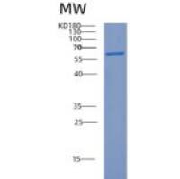 人胞浆多聚元件结合蛋白1(CPEB1)重组蛋白