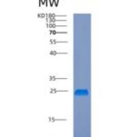 人内质网膜蛋白复合物亚单位8重组蛋白