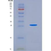 人氯化物细胞内通道蛋白1(CLIC1)重组蛋白