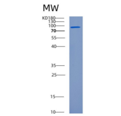 人半胱氨酸tRNA合成酶重组蛋白