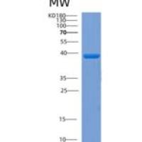 人大肠杆菌coaA(E.coli coaA)重组蛋白