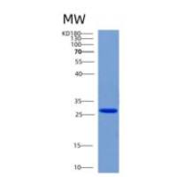 人CHMP6重组蛋白